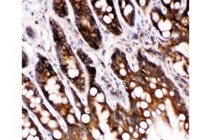 Immunohistochemistry (IHC) image for anti-Caspase 6, Apoptosis-Related Cysteine Peptidase (CASP6) (AA 7-27) antibody (ABIN3030314)