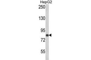 Western blot analysis of ECE1 Antibody (Center) in HepG2 cell line lysates (35ug/lane). (ECE1 Antikörper  (Middle Region))