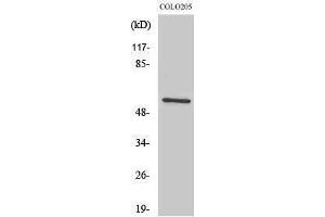 Western Blotting (WB) image for anti-IKAROS Family Zinc Finger 3 (Aiolos) (IKZF3) (Internal Region) antibody (ABIN3175609) (IKZF3 Antikörper  (Internal Region))
