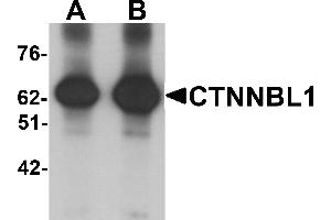 Western blot analysis of CTNNBL1 in human brain tissue lysate with CTNNBL1 antibody at (A) 1 and (B) 2 µg/mL. (CTNNBL1 Antikörper  (C-Term))
