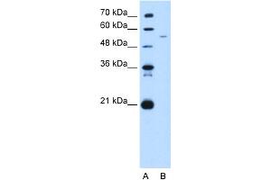 WB Suggested Anti-GAS7 Antibody Titration:  5. (GAS7 Antikörper  (C-Term))