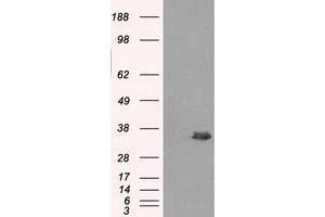 Image no. 1 for anti-Aldo-Keto Reductase Family 1, Member A1 (Aldehyde Reductase) (AKR1A1) antibody (ABIN1496547) (AKR1A1 Antikörper)