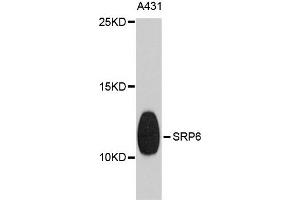 Western blot analysis of extracts of A431 cells, using SRP9 antibody. (SRP9 Antikörper)