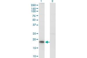 Western Blot analysis of KISS1 expression in transfected 293T cell line by KISS1 monoclonal antibody (M03), clone 1D11. (KISS1 Antikörper  (AA 46-145))