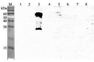 Western blot analysis using anti-ANGPTL3 (human), pAb  at 1:4'000 dilution. (ANGPTL3 Antikörper  (AA 194-213))