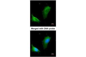 ICC/IF Image Immunofluorescence analysis of paraformaldehyde-fixed HeLa, using arginase I , antibody at 1:200 dilution. (Liver Arginase Antikörper)