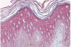 Human Skin: Formalin-Fixed, Paraffin-Embedded (FFPE) (FGFR1 Antikörper  (N-Term))