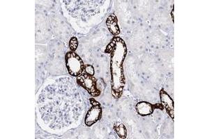 Immunohistochemical staining of human kidney with SLC17A2 polyclonal antibody  shows strong cytoplasmic and membranous positivity in cells in tubules at 1:50-1:200 dilution. (SLC17A2 Antikörper)
