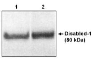 Image no. 1 for anti-Disabled Homolog 1 (Drosophila) (DAB1) (C-Term) antibody (ABIN264970) (DAB1 Antikörper  (C-Term))