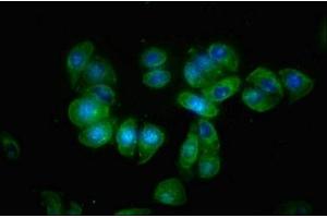 Immunofluorescence staining of HepG2 cells with ABIN7145515 at 1:66, counter-stained with DAPI. (Klotho beta Antikörper  (AA 1-130))