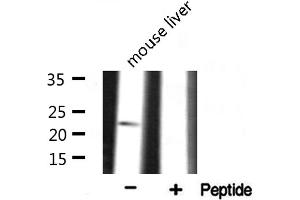 Western blot analysis on mouse liver lysate using RPS9 Antibody (RPS9 Antikörper  (Internal Region))