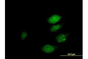 Immunofluorescence of purified MaxPab antibody to DUSP22 on HeLa cell. (DUSP22 Antikörper  (AA 1-184))