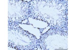 IHC analysis of MCM6 using anti-MCM6 antibody (ABIN7600037). (MCM6 Antikörper  (AA 14-821))
