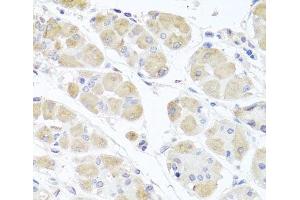 Immunohistochemistry of paraffin-embedded Human stomach using MSMB Polyclonal Antibody at dilution of 1:100 (40x lens). (MSMB Antikörper)