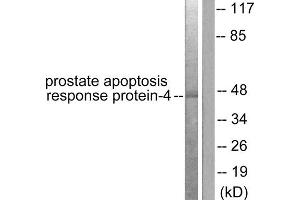 Western blot analysis of extracts from NIH/3T3 cells, using Prostate Apoptosis Response Protein-4 antibody (ABIN5976494). (PAWR Antikörper  (C-Term))