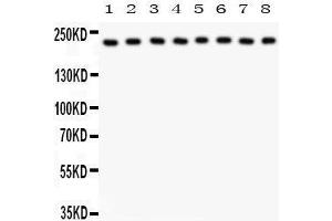 Anti- Integrin alpha 5 Picoband antibody, Western blotting All lanes: Anti Integrin alpha 5  at 0. (ITGA5 Antikörper  (AA 787-992))