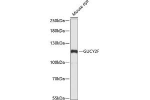 Western blot analysis of extracts of mouse eye, using GUCY2F antibody (ABIN7267553) at 1:1000 dilution.