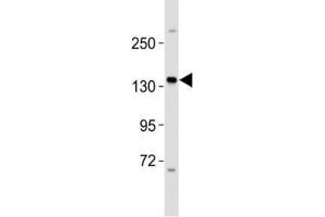 Western blot testing of ERBB4 antibody at 1:2000 dilution + MCF-7 lysate; Predicted molecular weight: 147-180 kDa (precursor), 120, 80 kDa (cleaved forms).