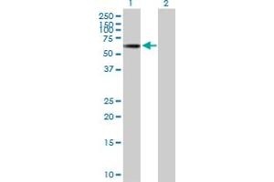 Western Blot analysis of TINAGL1 expression in transfected 293T cell line by TINAGL1 MaxPab polyclonal antibody.