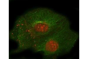 IF analysis of Thrombomodulin/THBD using anti-Thrombomodulin/THBD antibody (ABIN7601141) and anti-Tubulin Alpha antibody (ABIN7600339). (Thrombomodulin Antikörper  (AA 29-575))