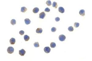 Immunocytochemistry of TLR6 in Jurkat cells with this product at 10 μg/ml. (TLR6 Antikörper  (N-Term))
