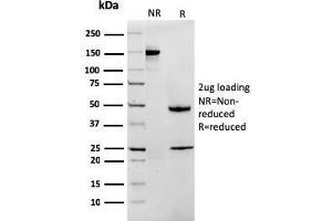 SDS-PAGE Analysis Purified MTAP Recombinant Mouse Monoclonal Antibody (rMTAP/1813).