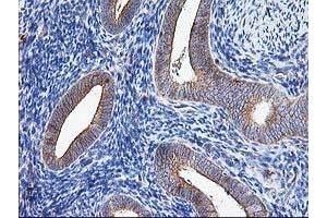 Image no. 2 for anti-ATG3 Autophagy Related 3 (ATG3) antibody (ABIN1496760) (ATG3 Antikörper)