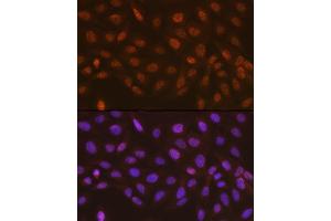 Immunofluorescence analysis of U-2 OS cells using Rad23A Rabbit mAb (ABIN7269824) at dilution of 1:100 (40x lens). (RAD23A Antikörper)