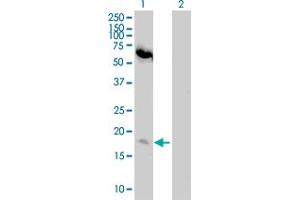 Lane 1: NUMB transfected lysate ( 14. (NUMB 293T Cell Transient Overexpression Lysate(Denatured))