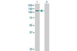 Lane 1: GAA transfected lysate ( 104. (GAA 293T Cell Transient Overexpression Lysate(Denatured))