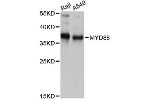 Western blot analysis of extracts of various cell lines, using MYD88 antibody (ABIN6290608) at 1:1000 dilution.
