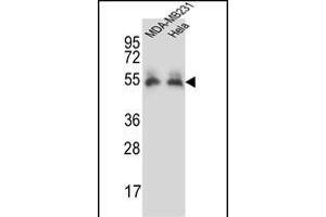 PRCP Antibody (N-term) (ABIN657308 and ABIN2846386) western blot analysis in MDA-M,Hela cell line lysates (35 μg/lane). (PRCP Antikörper  (N-Term))