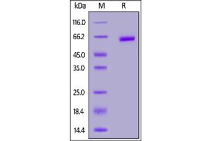 Human PLGF (19-221), Fc Tag on  under reducing (R) condition. (PLGF Protein (AA 19-221) (Fc Tag))