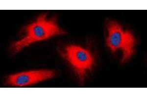 Immunofluorescent analysis of 14-3-3 zeta staining in HeLa cells. (14-3-3 zeta Antikörper  (Center))