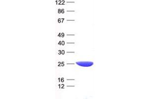 Validation with Western Blot (LYPLA1 Protein (His tag))