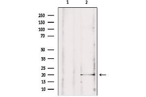 Western blot analysis of extracts from rat brain, using MPV17 antibody. (MPV17 Antikörper  (Internal Region))