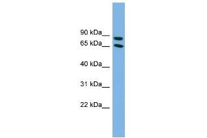 WB Suggested Anti-DAB1 Antibody Titration: 0. (DAB1 Antikörper  (Middle Region))
