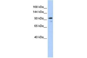 WB Suggested Anti-AMOTL1 Antibody Titration:  0. (AMOTL1 Antikörper  (N-Term))