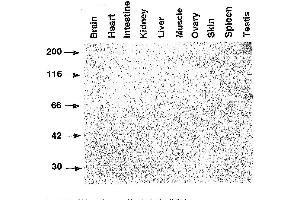 Western Blotting (WB) image for anti-SLA (Haploid Sperm Cell-Specific Antigen) antibody (ABIN3201019) (SLA (Haploid Sperm Cell-Specific Antigen) Antikörper)