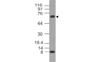 Image no. 1 for anti-Tumor Protein P73 (TP73) antibody (ABIN5027775) (Tumor Protein p73 Antikörper)