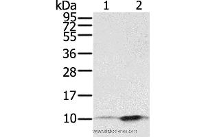 Western blot analysis of A431 and hela cell, using S100P Polyclonal Antibody at dilution of 1:650 (S100P Antikörper)
