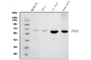 Western blot analysis of PTBP2 using anti-PTBP2 antibody (ABIN7599454).