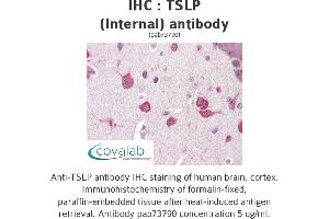 Image no. 1 for anti-Thymic Stromal Lymphopoietin (TSLP) (Internal Region) antibody (ABIN1740422) (Thymic Stromal Lymphopoietin Antikörper  (Internal Region))