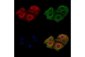 ABIN6256283 and ABIN6267449 staining Hela cells(4h of LPS treatment) by IF/ICC. (CXCR2 Antikörper  (pSer347))