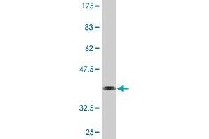 Western Blot detection against Immunogen (36. (HSFY1 Antikörper  (AA 1-99))