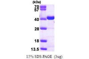 CrkL Protein (pTry207) (His tag)