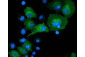 Image no. 2 for anti-DnaJ (Hsp40) Homolog, Subfamily A, Member 2 (DNAJA2) antibody (ABIN1497859) (DNAJA2 Antikörper)