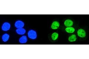 IF analysis of hnRNP D/AUF1/HNRNPD using anti-hnRNP D/AUF1/HNRNPD antibody (ABIN7602591).