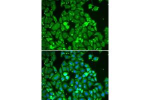 Immunofluorescence (IF) image for anti-Signal Transducer and Activator of Transcription 1, 91kDa (STAT1) (AA 513-712) antibody (ABIN3020615) (STAT1 Antikörper  (AA 513-712))