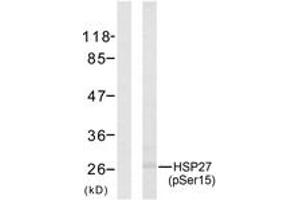 Western blot analysis of extracts from HeLa cells treated with UV, using HSP27 (Phospho-Ser15) Antibody. (HSP27 Antikörper  (pSer15))